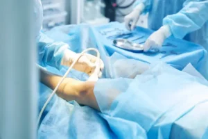 Top 12 Best Private Hospitals in Hyderabad for Vascular Surgery